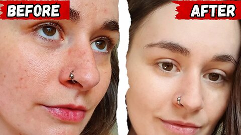 Bloated, Tired, and Dull Skin? Fix It from the Inside Out with PrimeBiome!
