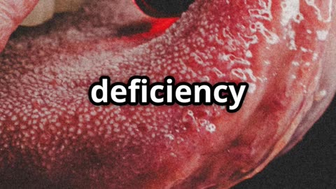 What Your Tongue Reveals About Your Health!