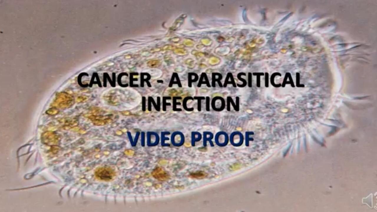 VIDEO PROOF: CANCER IS CAUSED BY PARASITES ~ by Lyra Nara Inc (2.21.18)