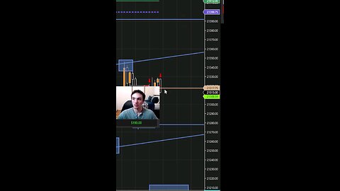 I Made $300 In Seconds Live Day Trading #scalping #daytrading #tradingstrategy #shorts #reels