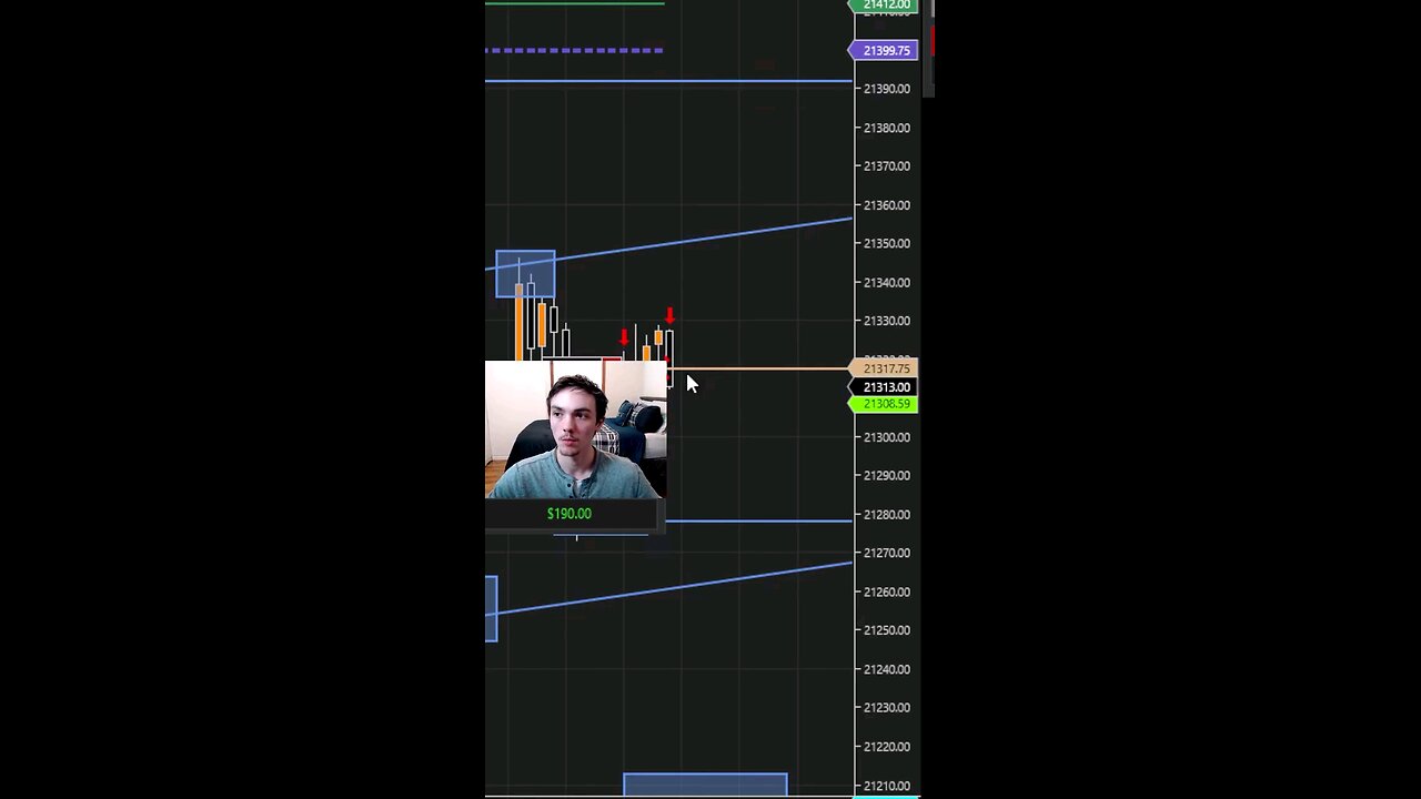 I Made $300 In Seconds Live Day Trading #scalping #daytrading #tradingstrategy #shorts #reels