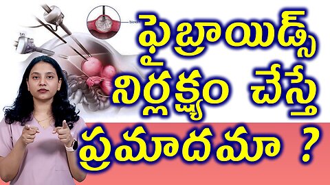 ఫైబ్రాయిడ్స్ నిర్లక్ష్యం చేస్తే ప్రమాదమా? Neglect Problems of Fibroids Removal Surgery Myomectomy