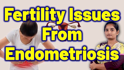 Endometriosis: Causes, Symptoms & Fertility Impact | Treatment Cure Medicine | Gynaecology Women