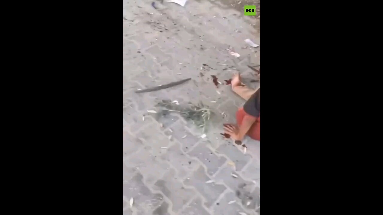 ‘Over 65 Palestinians killed’ in ISRAELI STRIKES today — Gaza hospital sources