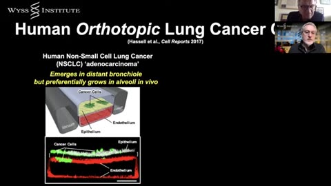 Human Organ Chips - From experimental models to clinical mimicry