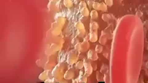 Honey Bee Venom cures what????