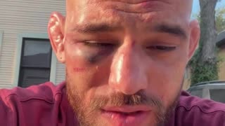 Jean Silva Shows His Injuries After Tough Loss to Diego Lopes