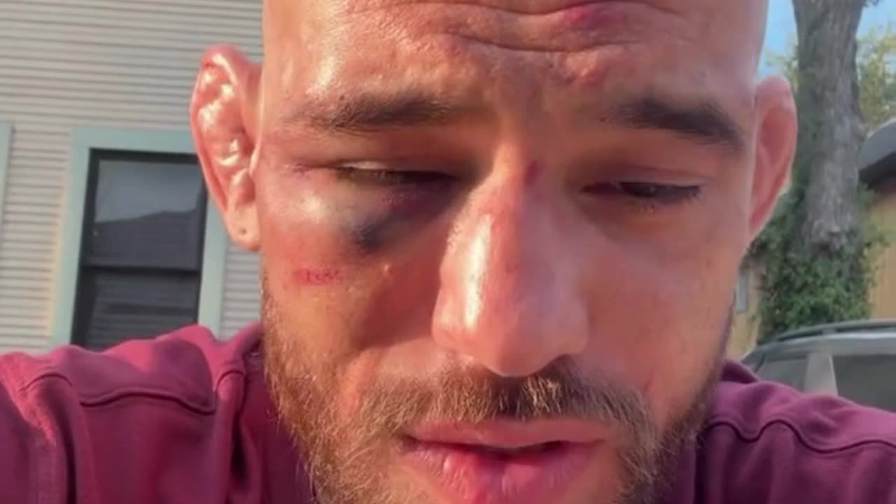 Jean Silva Shows His Injuries After Tough Loss to Diego Lopes
