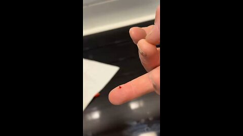 Satisfying Splinter Removal