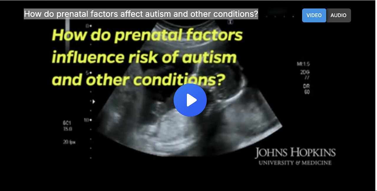 How do prenatal factors affect autism and other conditions?