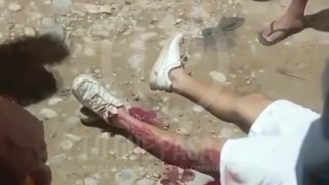 Violenta riña a machete en El Playón dejó dos heridos