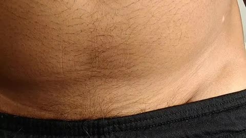 My C Section Scars (from Satanic Breeding Programs)