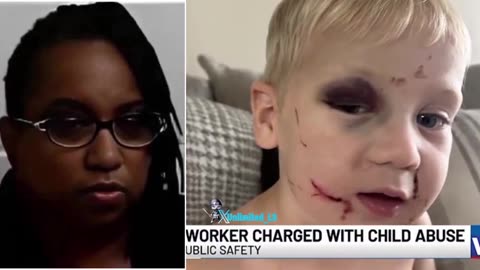 Day care worker in Georgia charged with first-degree child abuse after toddler injured on first day