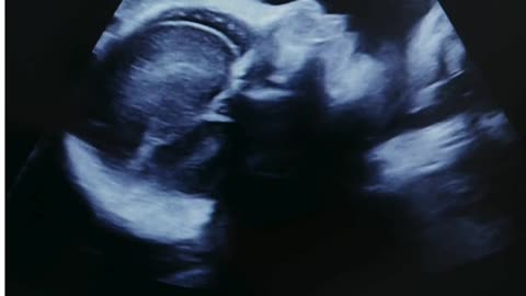Sumathi Hospital: Leading Test Tube Baby (IVF) Centre in Madurai