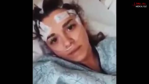 Brain Aneurysm COVID vaccine injury after Covid jab