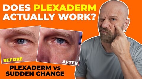 Old Dude Tries Plexaderm! Plexaderm vs Sudden Change.