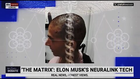 Nano Sapiens under the spell of Telezonia.... Brain-Computer-Interface is here