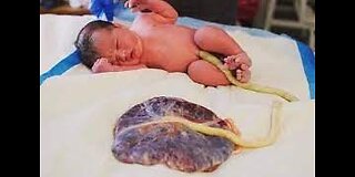 Umbilical Cord...