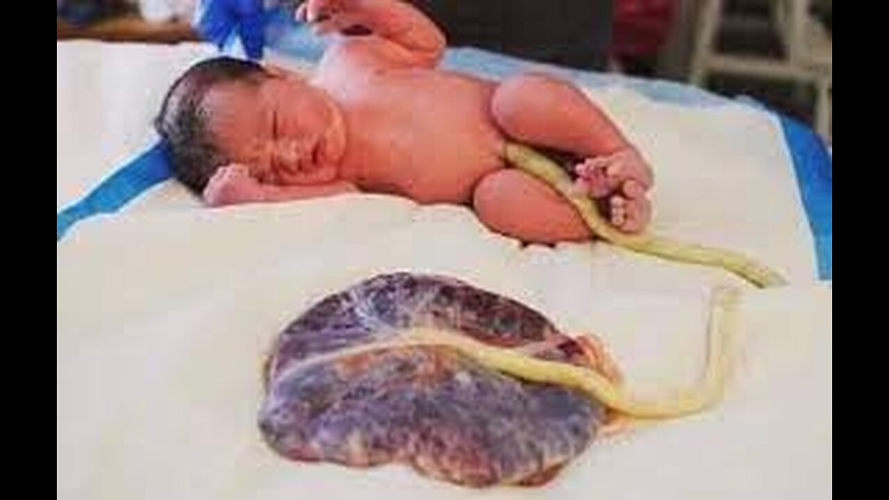 Umbilical Cord...