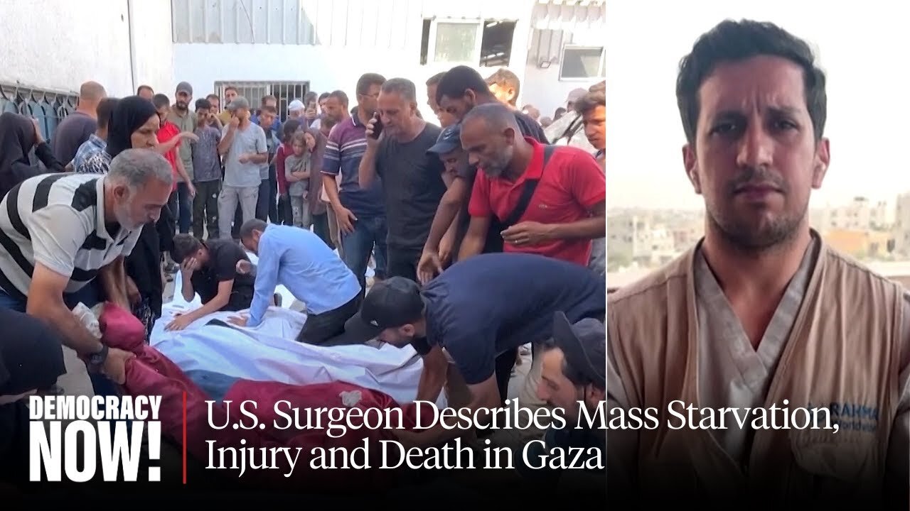 "Worst Thing I've Ever Seen": U.S. Surgeon Describes Mass Starvation, Injury and Death in Gaza
