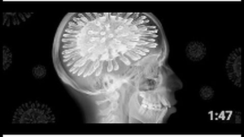 "Covid Now Attacks Brain Tissue: Echoes of Previous Health Warnings"