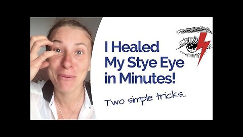 How I Healed 'Stye Eye' Naturally and Fast, Relief in Just 30 Minutes!