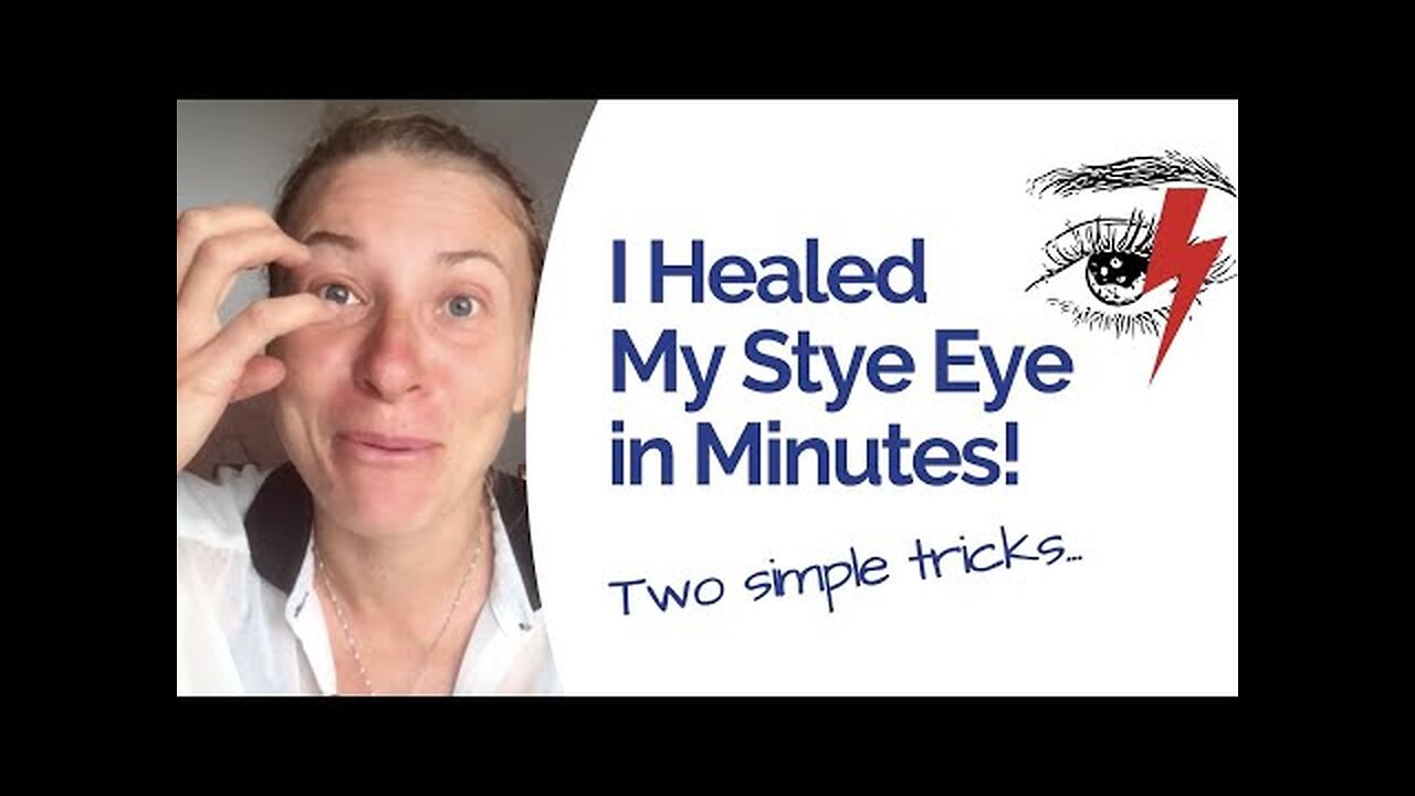How I Healed 'Stye Eye' Naturally and Fast, Relief in Just 30 Minutes!
