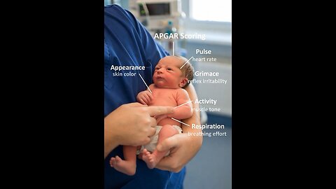 APGAR Score 3D Animation #3dmedico