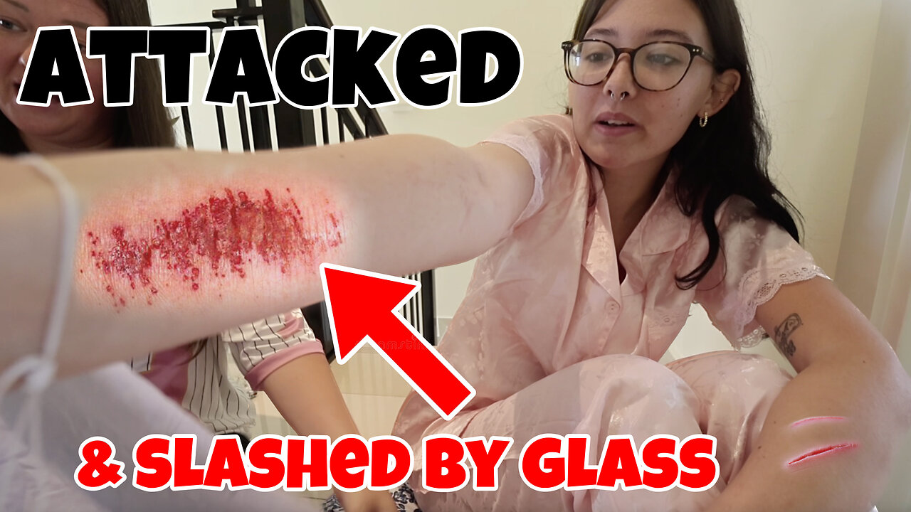 MY SISTER DID THIS TO ME..