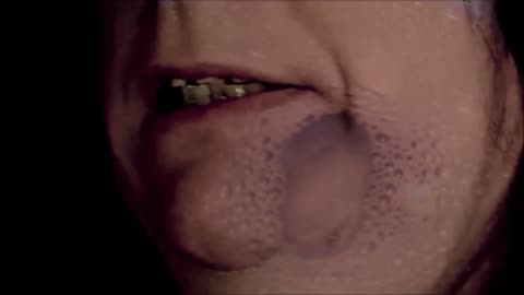 Michele Marie Dalene's Disgusting Dentition