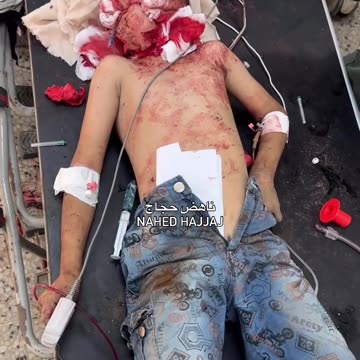 A child in critical condition lies alone in the intensive care unit at Al-Shifa Hospital (Graphic)