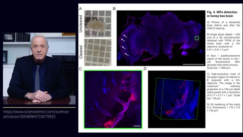 How Nanoplastics Affect The Brain And Cognitive Functions