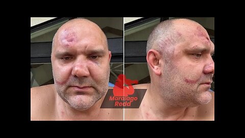 White man attacked by group of Blacks in Cincinnati, OH, apprehended.