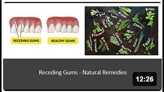 Receding Gums Natural Treatment
