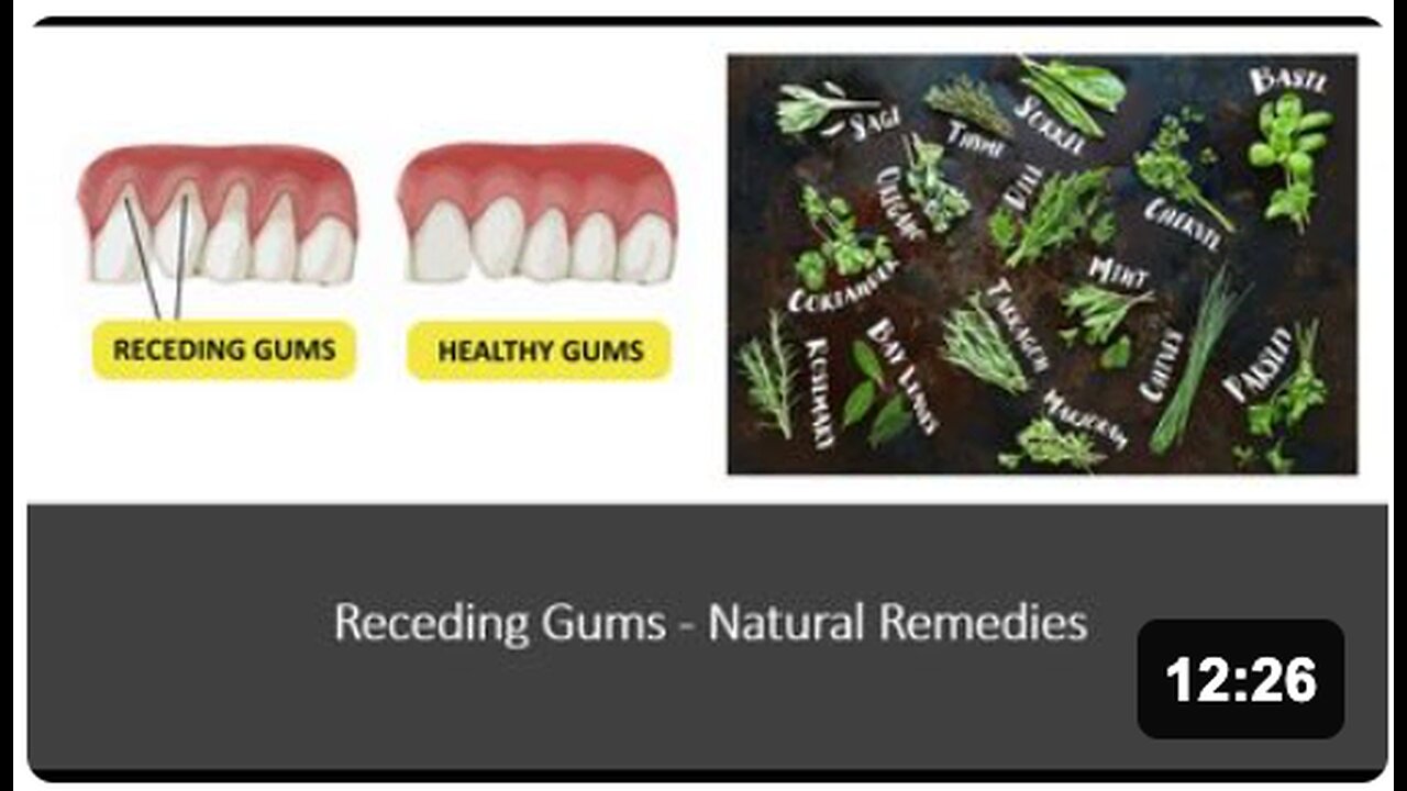 Receding Gums Natural Treatment