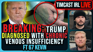 BREAKING: Trump Diagnosed With Chronic Vein Disease, Covers Bruised Hands With Make Up | Timcast IRL