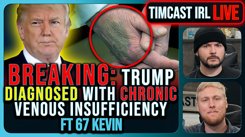 BREAKING: Trump Diagnosed With Chronic Vein Disease, Covers Bruised Hands With Make Up | Timcast IRL
