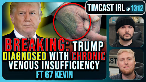 BREAKING: Trump Diagnosed With Chronic Vein Disease, Covers Bruised Hands With Make Up | Timcast IRL