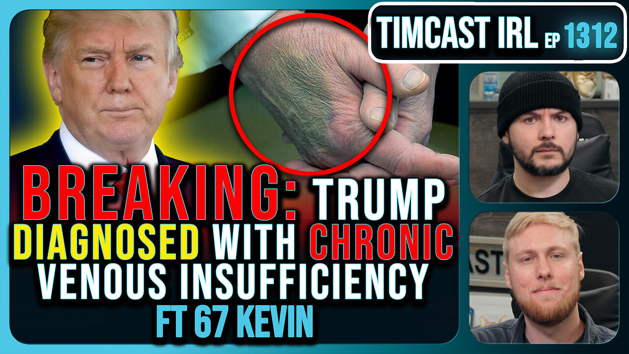 BREAKING: Trump Diagnosed With Chronic Vein Disease, Covers Bruised Hands With Make Up | Timcast IRL