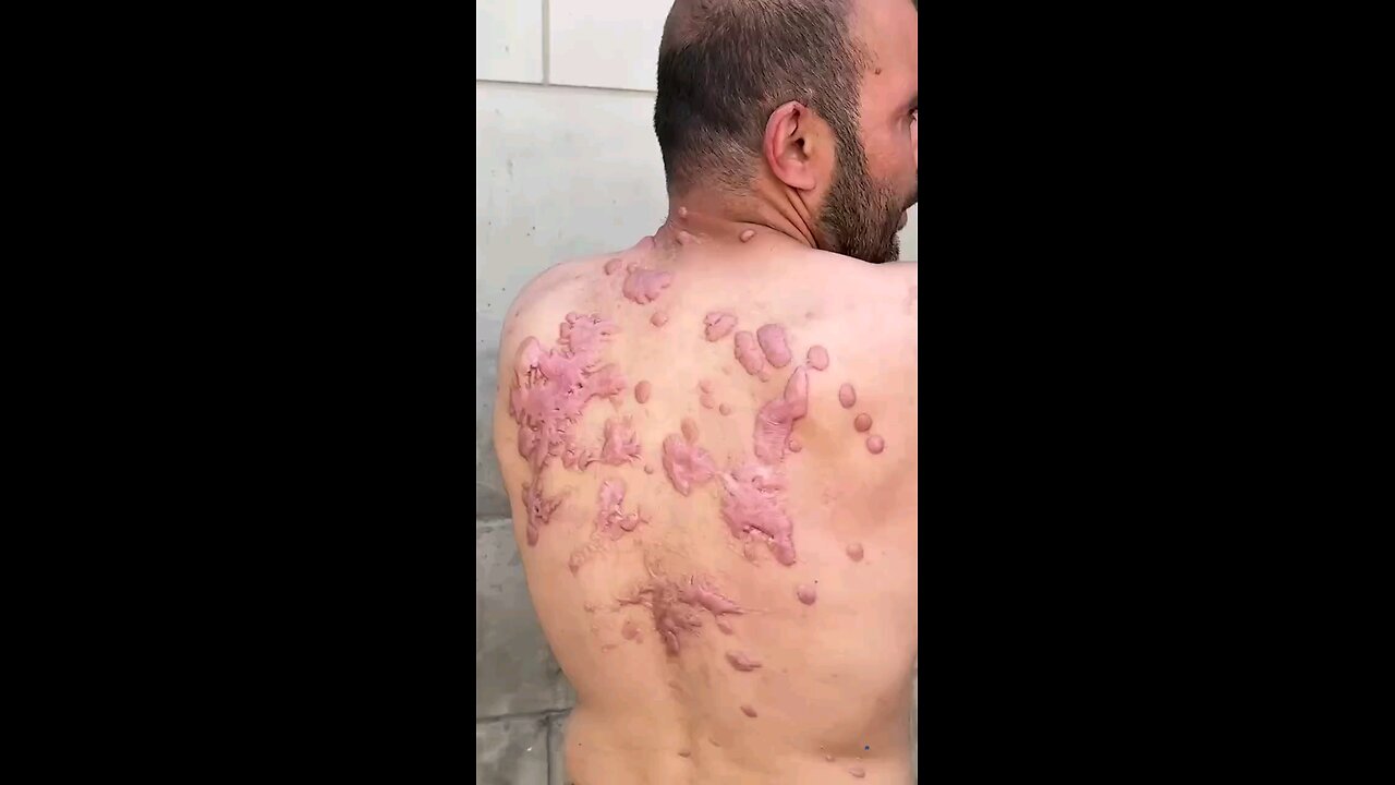 La malvagità degli israeliani.