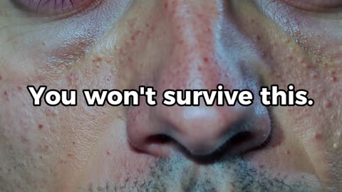 This is what happens if you don’t sleep for 7 days… 😨