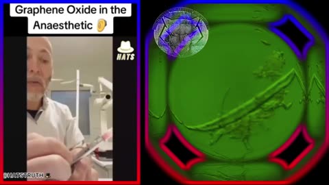 These days, graphene oxide appears to be a component of every dental anesthetic.