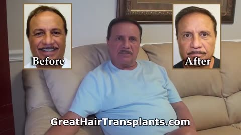 Great Hair Transplants: Hair Restoration with Dr. Brett Bolton