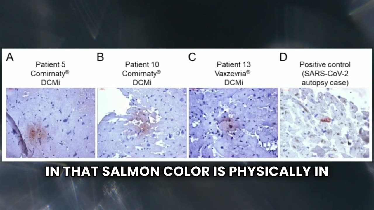 DrPeter McCullough - Health Issues due to Spike Protein