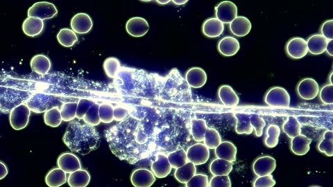 Hydrogel Filament with Nanobots