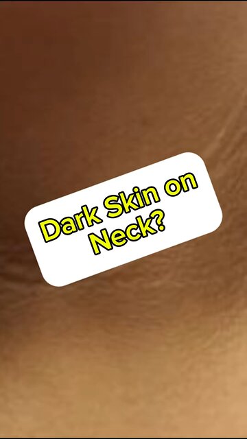 Dark skin around the neck?