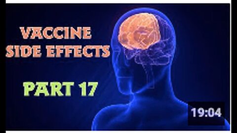 "Part 17: Side Effects of Vaccines"