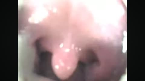 Throat 1