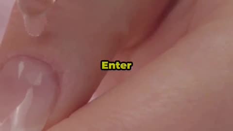 Metanail Serum Pro: The DIY Toenail Fungus Fix!