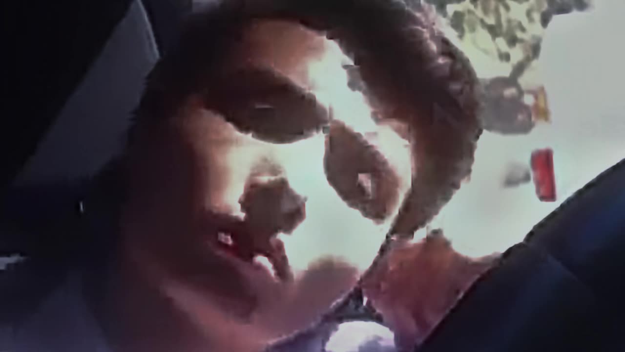ER edit